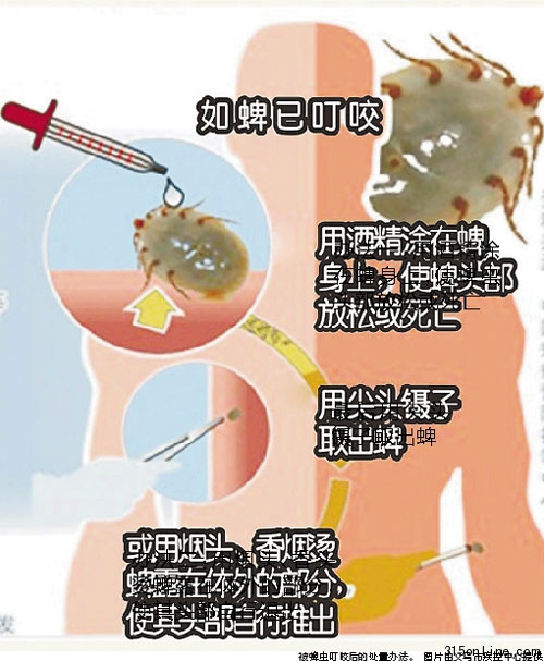 菜地干活后高燒不退八旬翁被蜱蟲叮咬致死