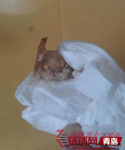 吃出水銀狀物體的豬大腸。原文配圖