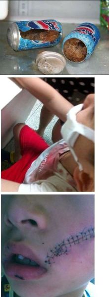 上海嘉定一男孩從冰箱冷凍室拿出一聽百事可樂,開啟瞬間突然發(fā)生爆炸。圖片來源:消費者微博